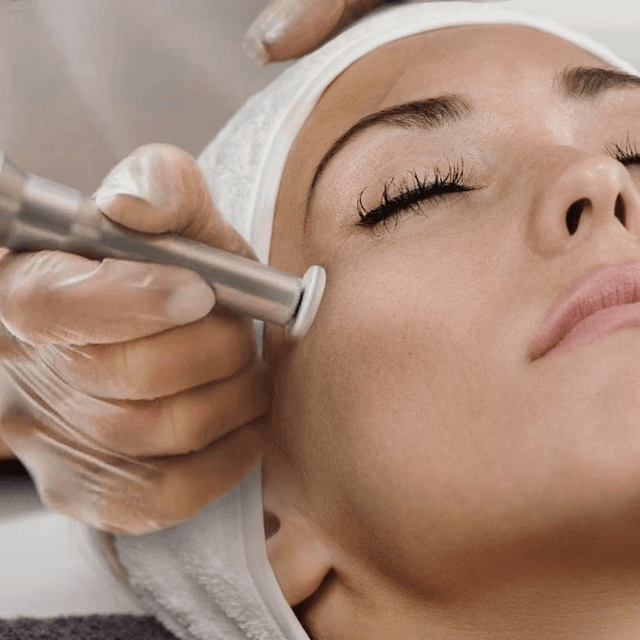 Elite Skin Membership at Haus of Smiles in St. Charles, MO